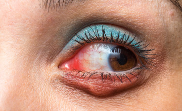 A gyulladt szem doktora: Orvosi szemvidító fű